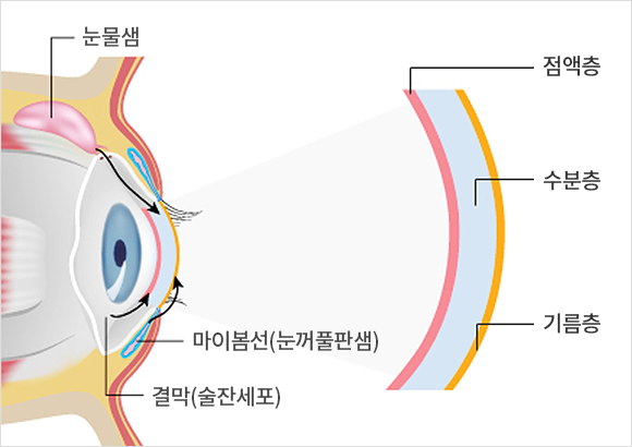 안구건조증의 원인