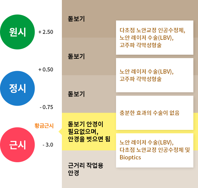 백내장이 없는 경우