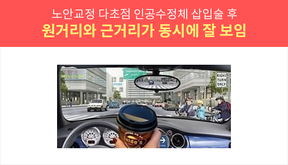 노안교정 다초점 인공수정체 장점