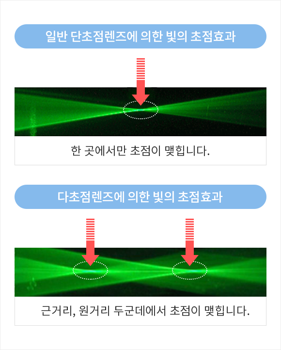 노안교정 다초점 인공수정체 장점