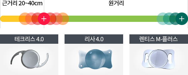 개인맞춤 노안 다초점 렌즈삽입술1