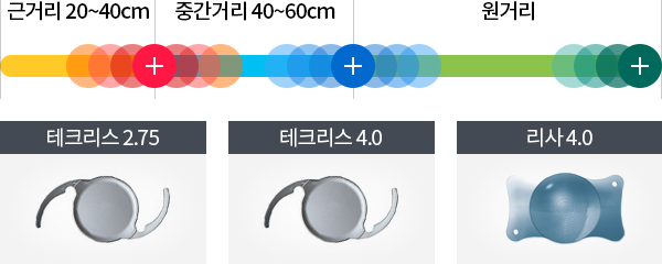 개인맞춤 노안 다초점 렌즈삽입술1
