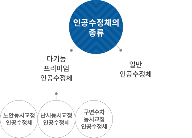 백내장의 원인