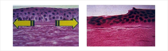 각막상피의 이동